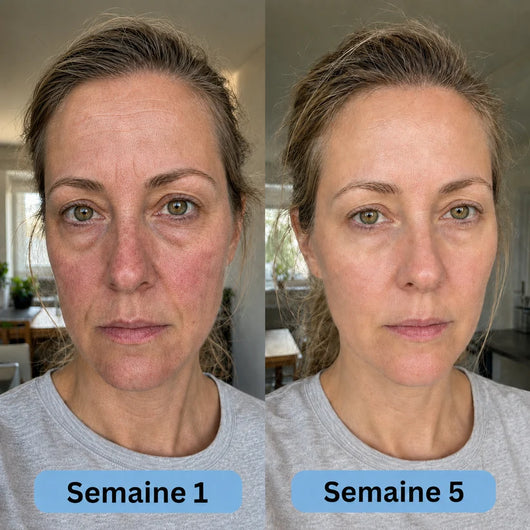 VoluFine | Sérum coréen au collagène pour peaux matures