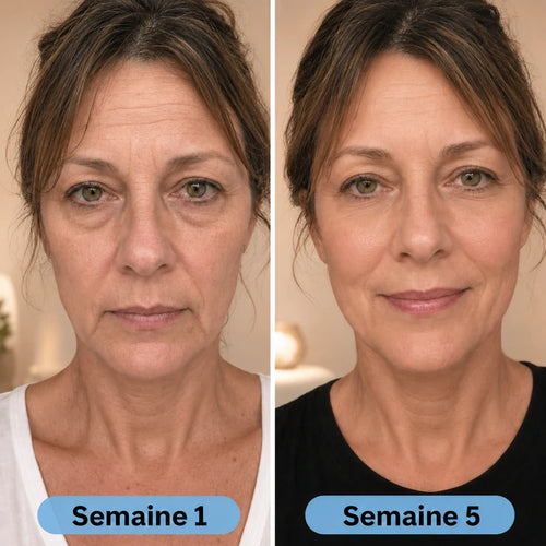 VoluFine | Sérum coréen au collagène pour peaux matures
