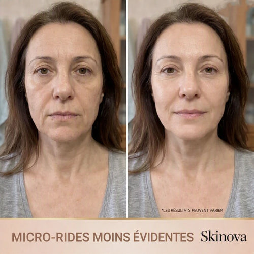 Skinova - Sérum Coréen Effet Lifting dès la Première Application
