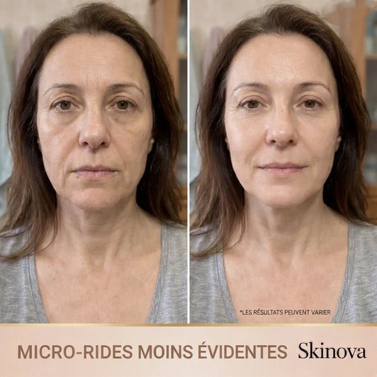 Skinova - Sérum Coréen Effet Lifting dès la Première Application