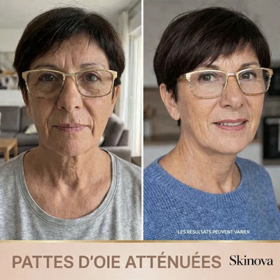 Skinova - Sérum Coréen Effet Lifting dès la Première Application