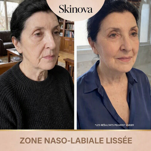 Skinova - Sérum Coréen Effet Lifting dès la Première Application