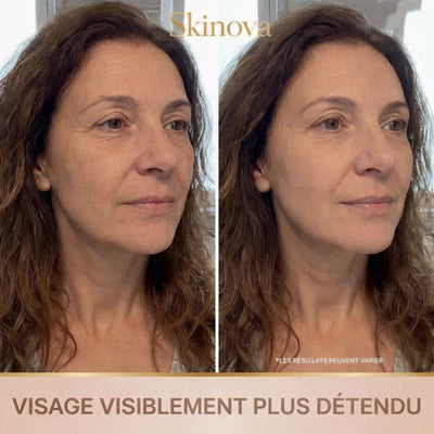 Skinova - Sérum Coréen Effet Lifting dès la Première Application
