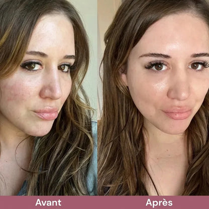 Exfoliant au riz coréen