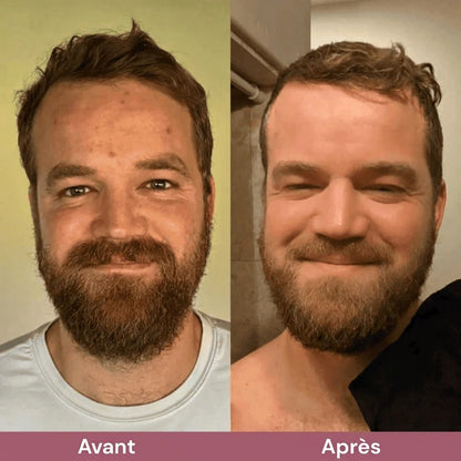 Exfoliant au riz coréen