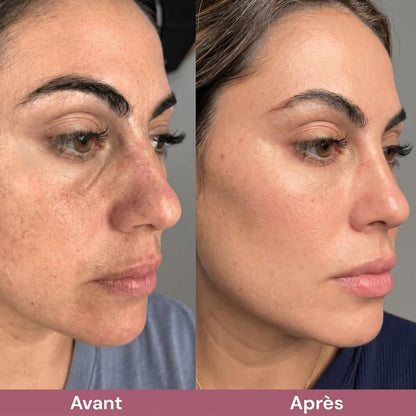 Exfoliant au riz coréen