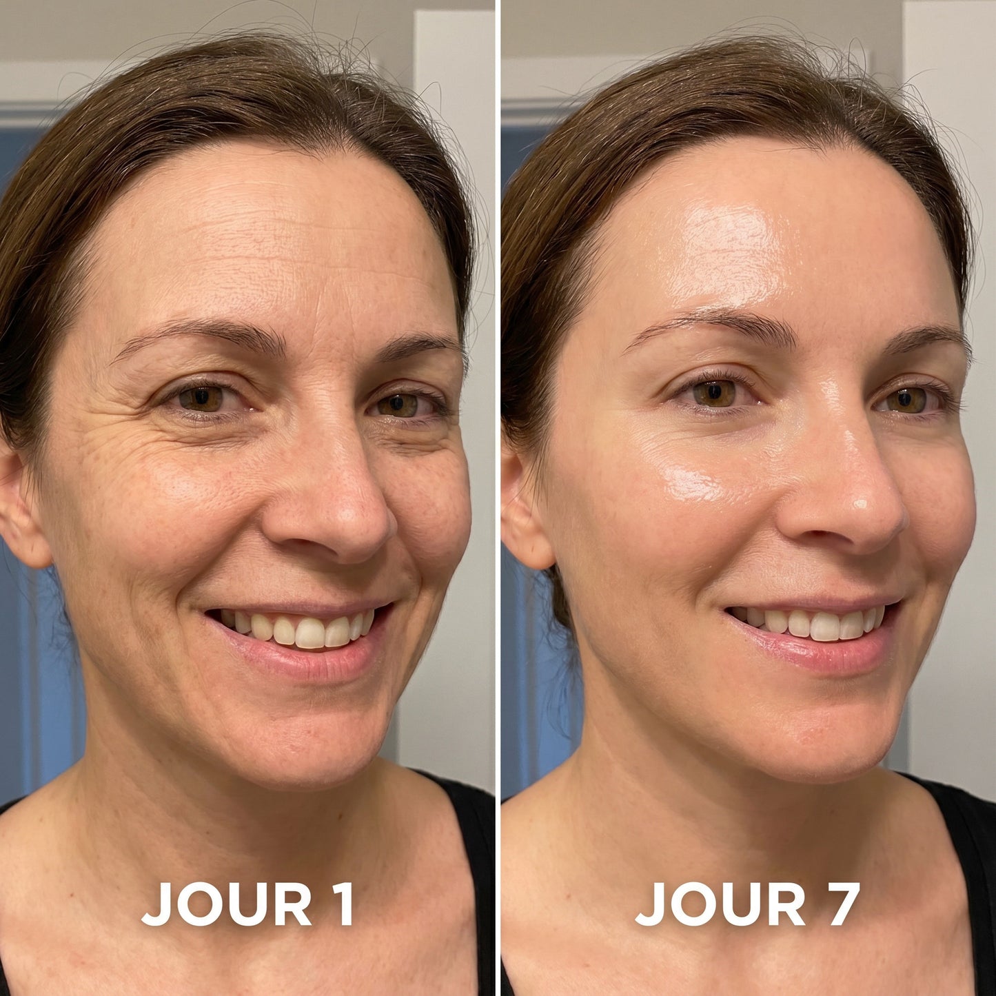 Skinova Paris™ | Raffermit et affine la peau relâchée de 98 % en 24 heures