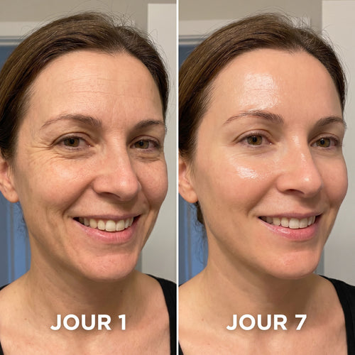 Skinova Paris™ | Raffermit et affine la peau relâchée de 98 % en 24 heures