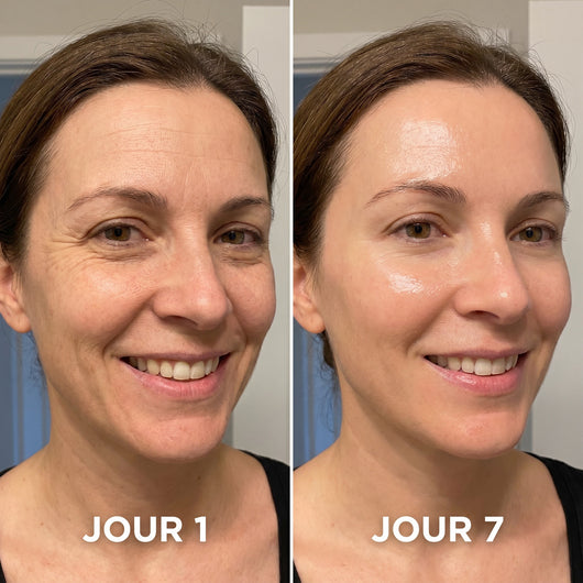 Skinova Paris™ | Raffermit et affine la peau relâchée de 98 % en 24 heures