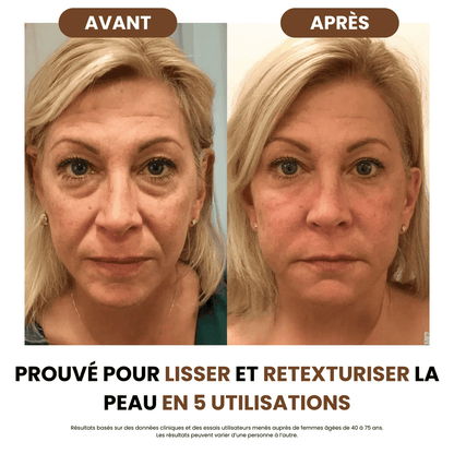 Brosse de drainage lymphatique Skinova Paris™