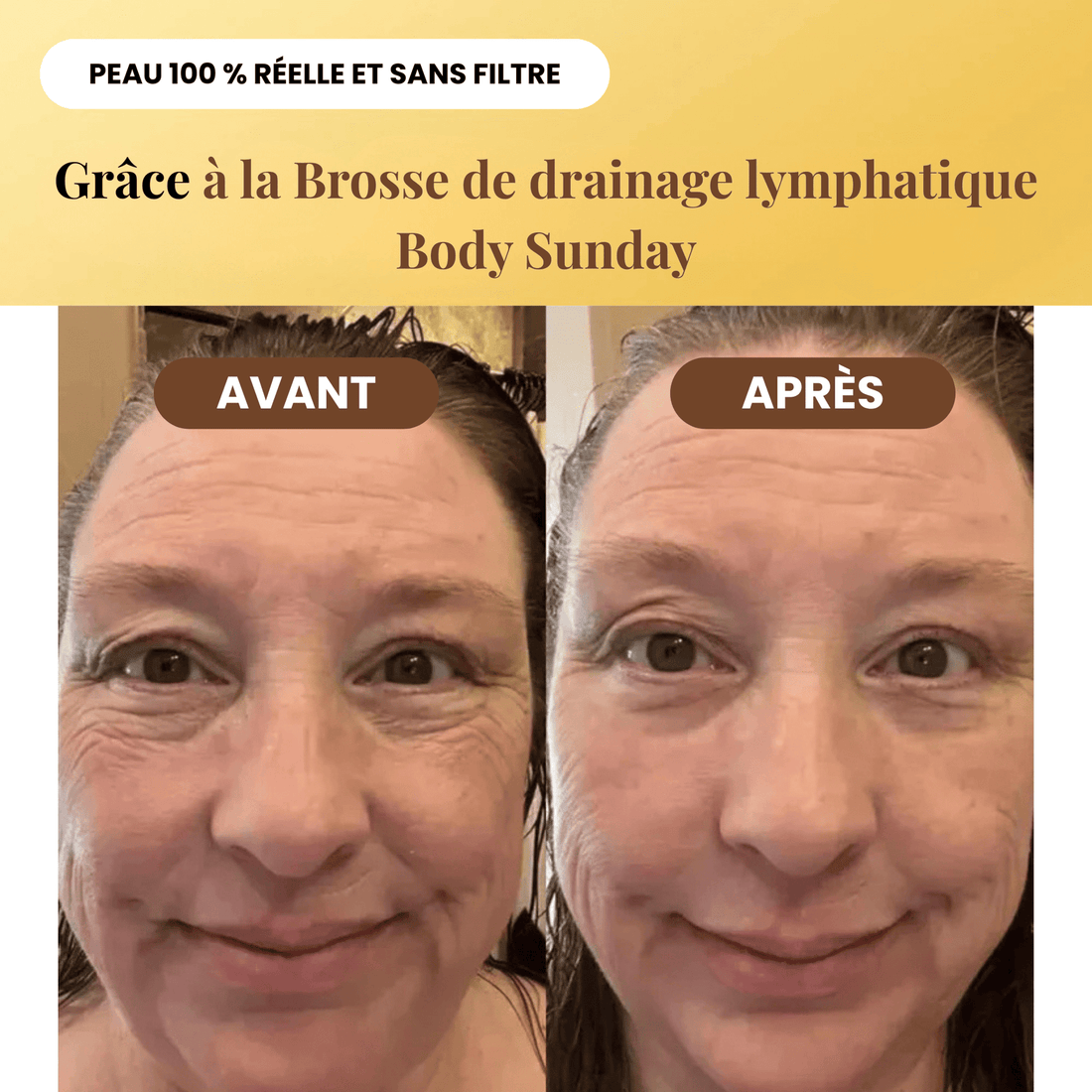 Brosse de drainage lymphatique Skinova Paris™
