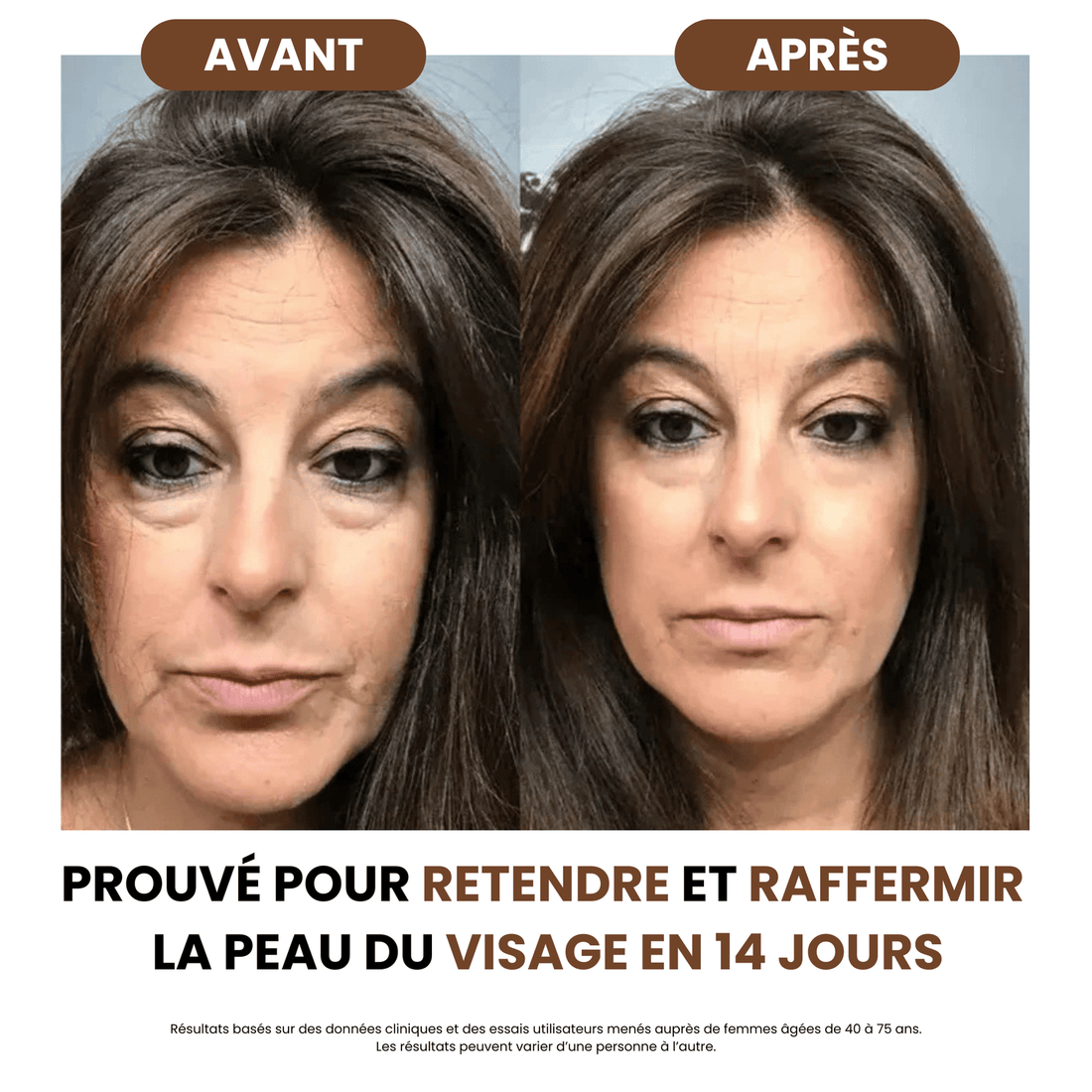 Brosse de drainage lymphatique Skinova Paris™
