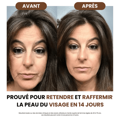 Brosse de drainage lymphatique Skinova Paris™