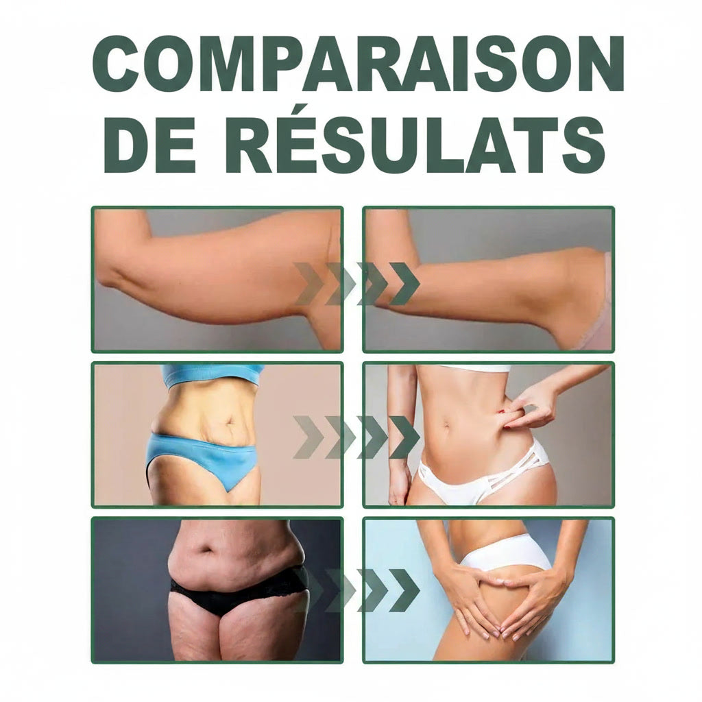 Skinova Paris™ | Raffermit et affine la peau relâchée de 98 % en 24 heures