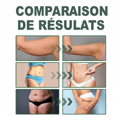 Skinova Paris™ | Raffermit et affine la peau relâchée de 98 % en 24 heures