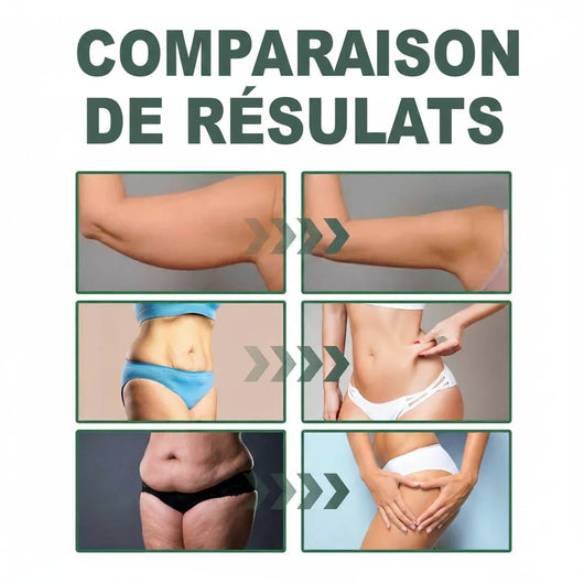 Skinova Paris™ | Raffermit et affine la peau relâchée de 98 % en 24 heures