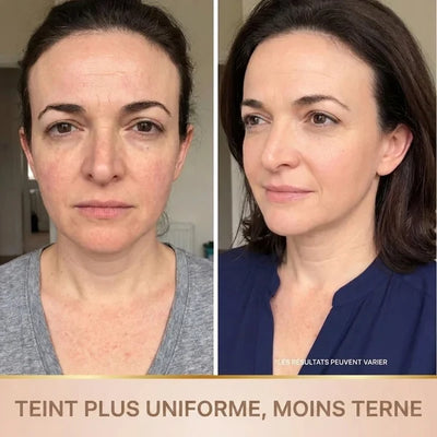 Skinova - Sérum Coréen Effet Lifting dès la Première Application