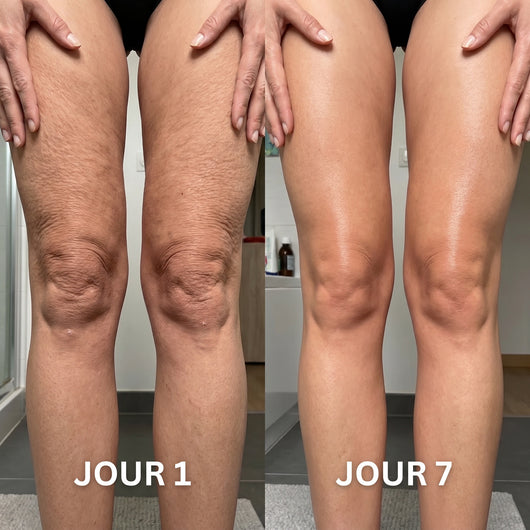 Skinova Paris™ | Raffermit et affine la peau relâchée de 98 % en 24 heures